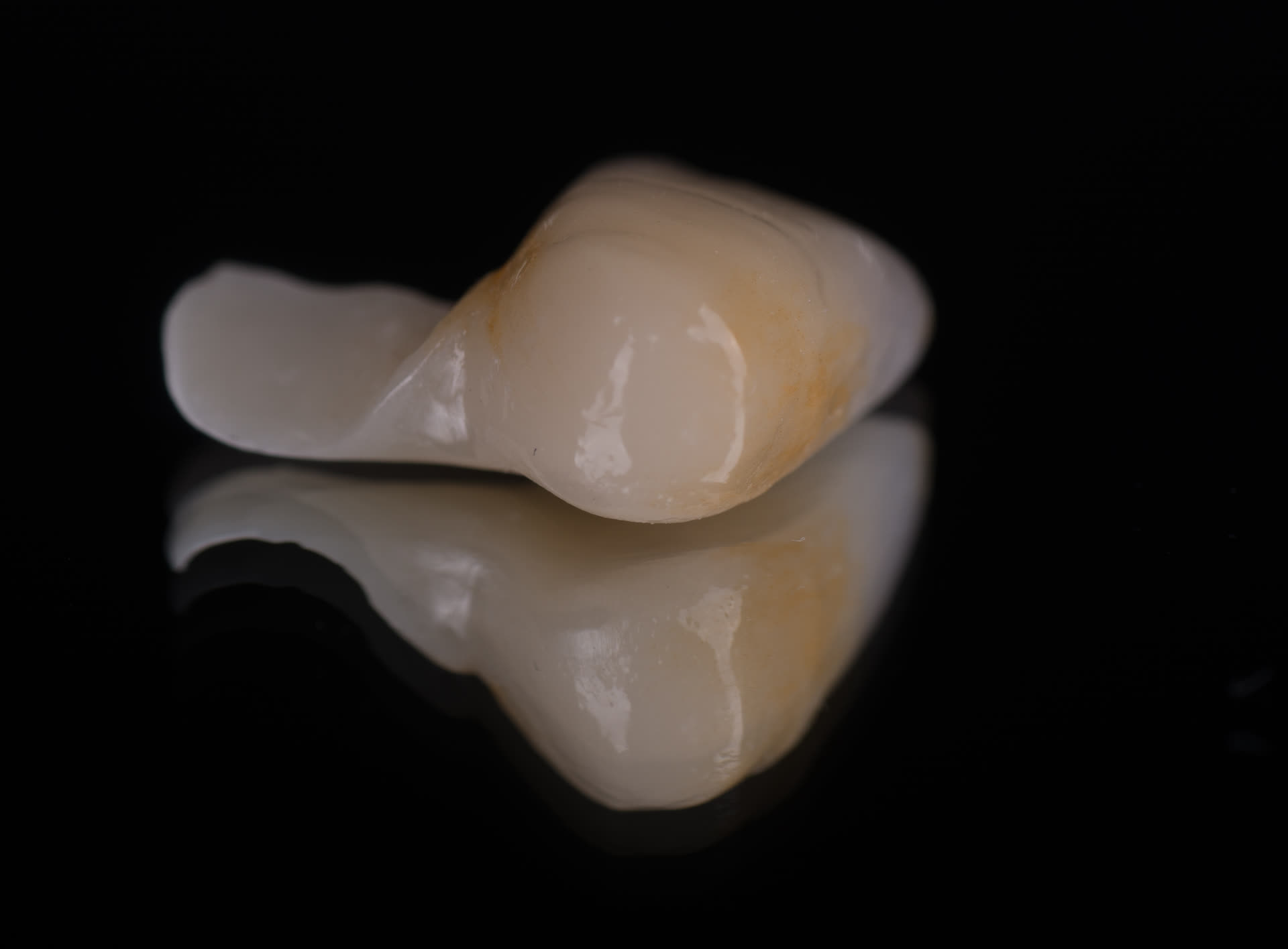 Puente Maryland adhesivo de zirconio en cantilever sobre modelo de trabajo